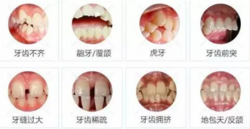 *病可以做种植牙吗,活动假牙磨损后